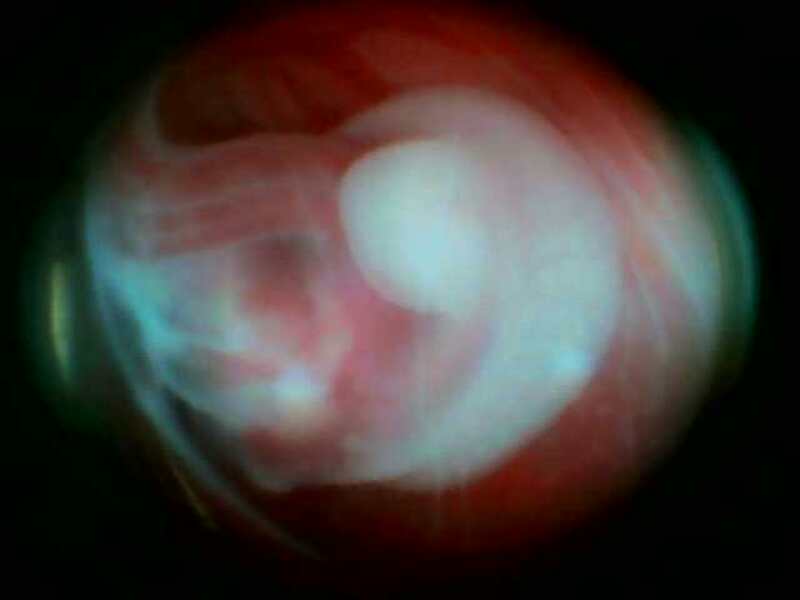 7胚胎组织.jpg
